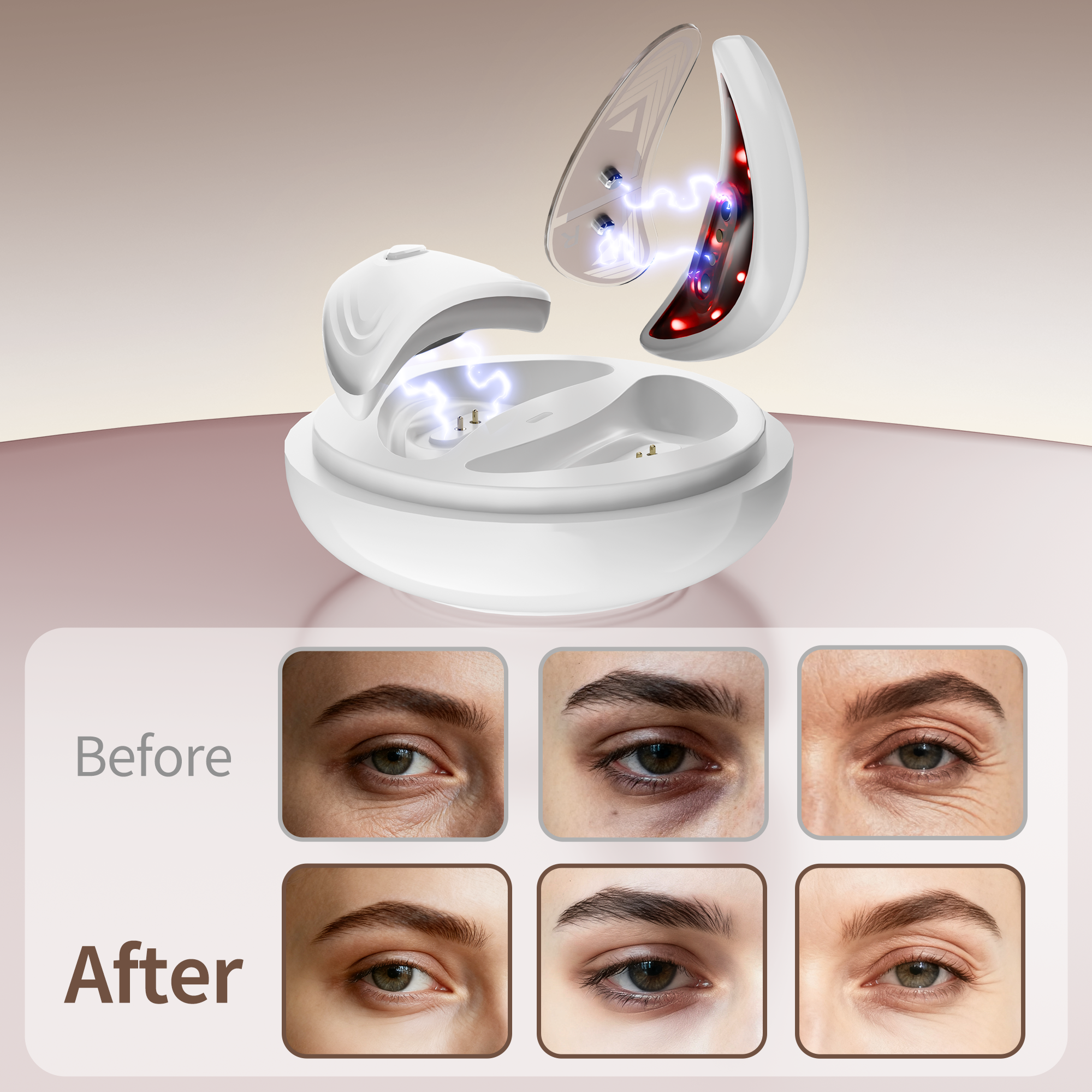 2026 Professional Under - Eye Treatment Microcurrent Technology